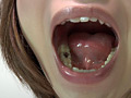 歯06のサンプル画像7