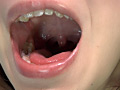 歯06のサンプル画像8