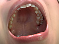 歯06のサンプル画像9