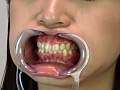 歯07のサンプル画像3