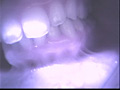 歯07のサンプル画像4