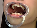 歯07のサンプル画像8