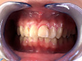 歯10のサンプル画像6
