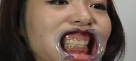 こずえまき出演作品: 歯12