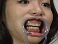 [fetishjapan-0027] 歯12 こずえまきのキャプチャ画像 4