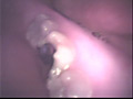 [fetishjapan-0027] 歯12 こずえまきのキャプチャ画像 5