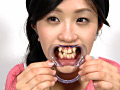 歯13のサンプル画像3
