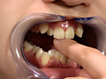 歯13 サンプル画像8