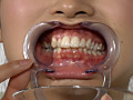 [fetishjapan-0029] 歯14 安達なつみのキャプチャ画像 10