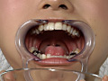 歯14のサンプル画像11