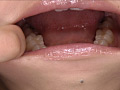 歯15 サンプル画像3