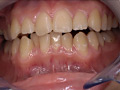 歯15のサンプル画像6