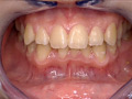 歯15 サンプル画像8