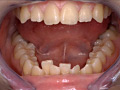 歯15のサンプル画像9