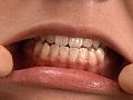 歯16のサンプル画像3