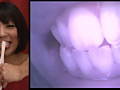 歯16のサンプル画像6