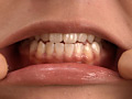 歯16のサンプル画像11