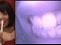 歯16のサンプル画像13