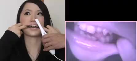 美咲あすみ出演作品: 歯19