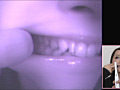歯19のサンプル画像2