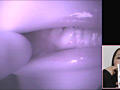 歯19のサンプル画像3