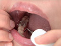 [fetishjapan-0772] 銀歯インレーフェチ 咲希の口内には銀歯がいっぱい！ 横尾咲希のキャプチャ画像 5