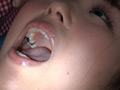歯フェチ！処置室 つぐみちゃん 銀歯がキラリ サンプル画像2