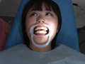 歯フェチ！処置室 つぐみちゃん 銀歯がキラリ...thumbnai3