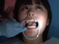 歯フェチ！処置室 つぐみちゃん 銀歯がキラリ サンプル画像6
