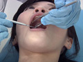 歯フェチ！処置室 さらちゃん 銀歯がキラリ サンプル画像3
