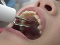歯フェチ！処置室 さらちゃん 銀歯がキラリ サンプル画像4