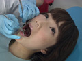 歯フェチ！処置室 ゆうこちゃん 銀歯がキラリ サンプル画像1