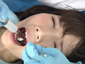 歯フェチ！処置室 ゆうこちゃん 銀歯がキラリ サンプル画像2