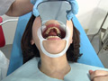 [fetishjapan-0818] 歯フェチ！処置室 ゆうこちゃん 銀歯がキラリ 大橋優子のキャプチャ画像 5