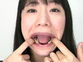 [fetishjapan-0850] 歯フェチ！レア美熟女の銀歯観察 優奈 小室優奈のキャプチャ画像 1