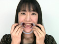 FJD-0853 歯フェチ！レア美熟女の銀歯観察 優奈 無料画像1