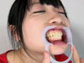 [fetishjapan-0867] 銀歯フェチ！口内歯観察 安達まどかのキャプチャ画像 4