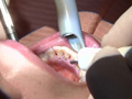 ガチ歯科治療歯周病？歯肉縁下歯石除去 星野桃子 サンプル画像1
