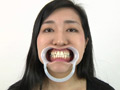 銀歯フェチ歯観察 由香里さんの口内 サンプル画像2