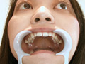 歯フェチ！本物の歯治療映像【抜歯】 ミランダ サンプル画像2
