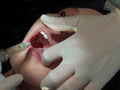 歯フェチ！本物の歯治療映像【抜歯】 ミランダ サンプル画像4