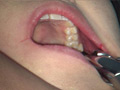 歯フェチ！本物の歯治療映像【抜歯】 ミランダ サンプル画像10