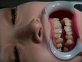 [fetishjapan-0915] 歯フェチ！本物の歯治療映像 小百合 前沢小百合のキャプチャ画像 5