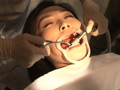 [fetishjapan-0915] 歯フェチ！本物の歯治療映像 小百合 前沢小百合のキャプチャ画像 6