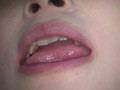 [fetishjapan-0915] 歯フェチ！本物の歯治療映像 小百合 前沢小百合のキャプチャ画像 8