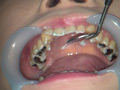 [fetishjapan-0915] 歯フェチ！本物の歯治療映像 小百合 前沢小百合のキャプチャ画像 10