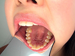 口腔：歯フェチ！歯観察 美穂の口内
