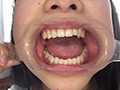 歯フェチ！歯観察 美穂の口内 サンプル画像3