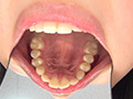 歯フェチ！歯観察 美穂の口内 サンプル画像5