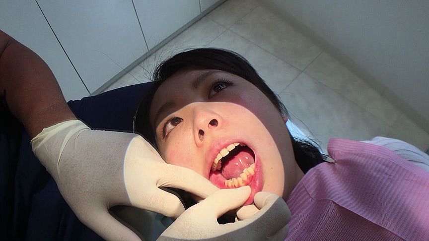 歯フェチ！本物歯治療映像色素沈着研磨除去＆歯石除去 | DUGAエロ動画データベース